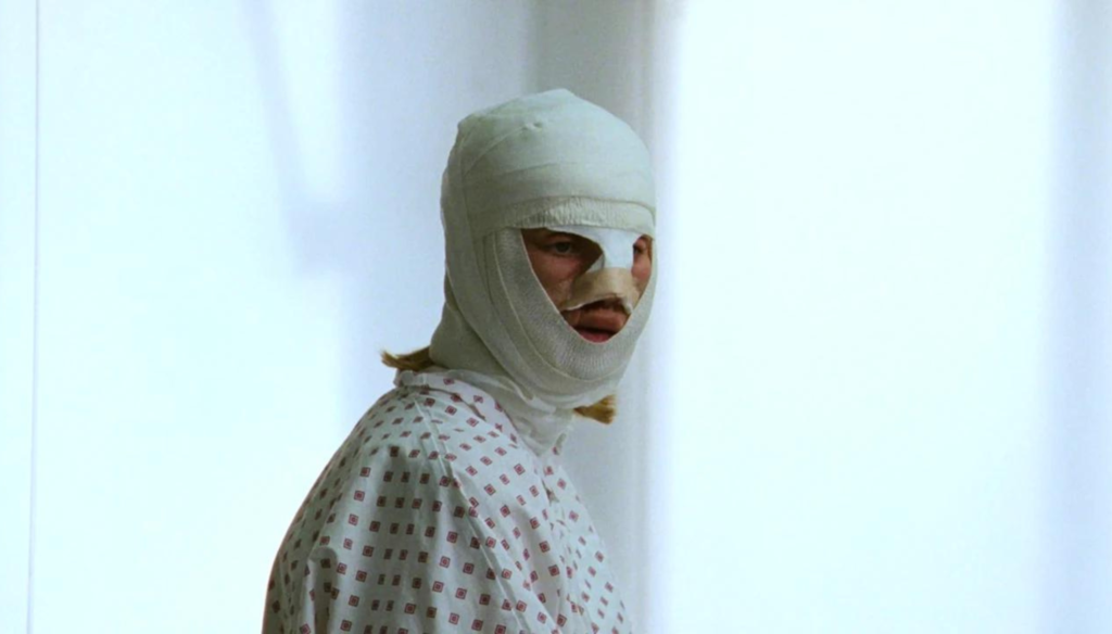Kristine Kujath Thorp (Signe) coperta di bende in una scena di Sick of myself (2022) di Kristoffer Borgli 