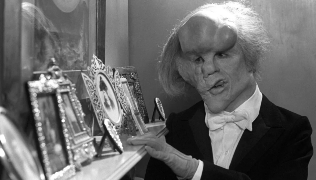 John Hurt in una scena di The Elephant Man (1980) di David Lynch